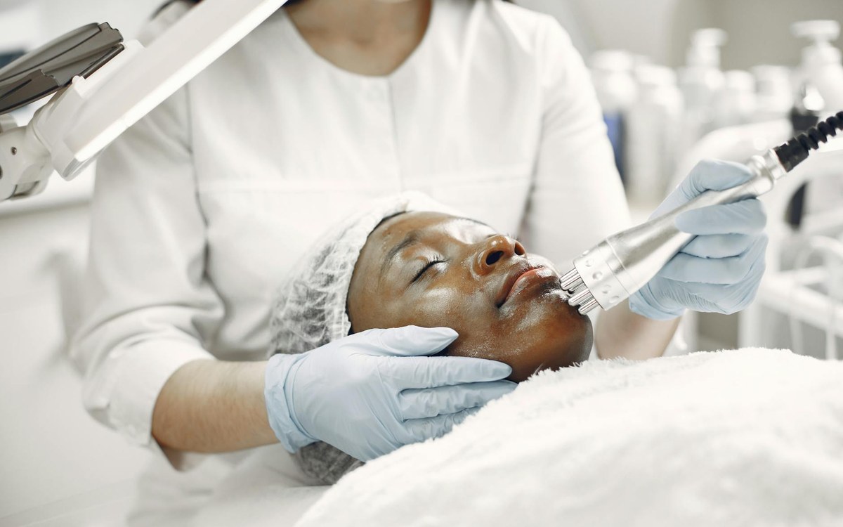 tratamiento dermatológico para el melasma facial