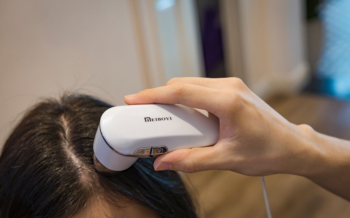 Análisis del cuero cabelludo para valorar la caída del cabello