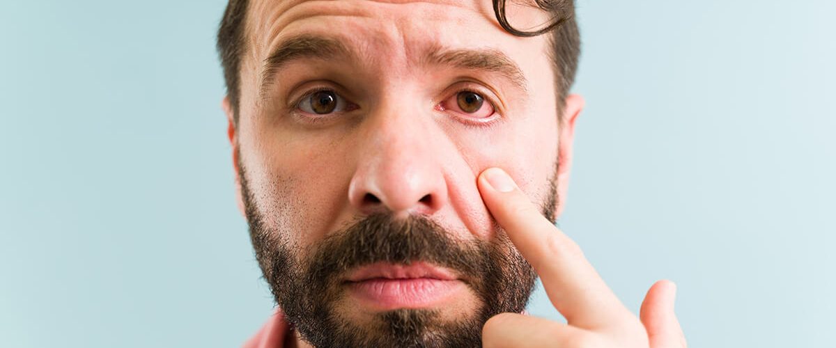 infecciones oculares