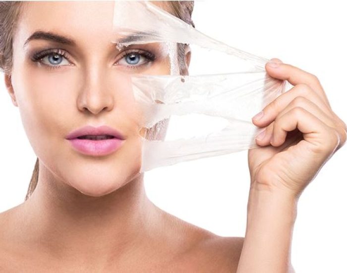 técnicas aplicadas peelings químicos